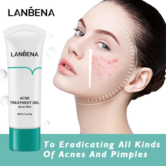 LANBENA Acne Treatment Cream Remove Blackheads Pimples Gel Face Clean Effective Fade Marks Scars Refreshing Repair Damaged Skin